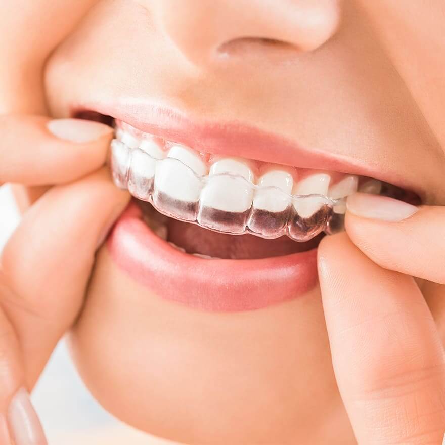 審美歯科